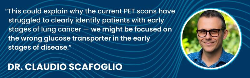Quote from Dr. Scafoglio about why his research is exciting, it may have found a biomarker for early lung cancer