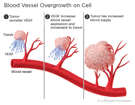 Blood vessel overgrowth