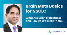 Brain mets basics for nsclc